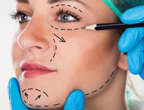 Botched Cosmetic Surgery – What To Do If You’re A Victim